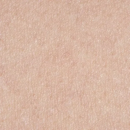 pelle_spenta_stressata